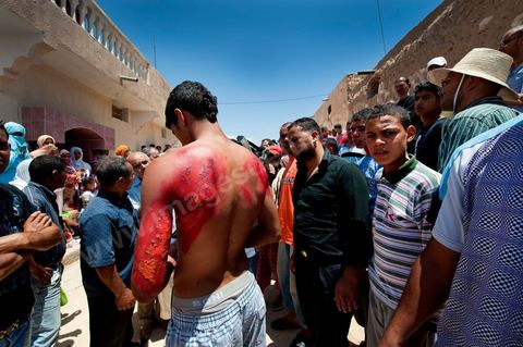 Jeune homme agressé à l'essence de la tribu des jeridiens lors des affrontements du 3 au 5 juin 2011 dans la ville de Metlaoui