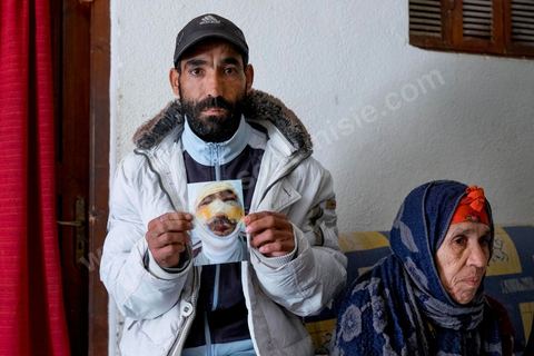 29 janvier 2016 : Baligh Aloui, 33 ans, s'est immolé le jeudi 21 janvier devant sa maison familiale où il vit avec ses parents, frères et soeurs. C'est son frère, Abdelsattar, qui l'a sauvé en se jetant sur lui. A lhopital de Kasserine depuis une semaine son état de santé est stable mais il est brulé au visage et mains au second degrès. Il s'est immolé ce jeudi 21 janvier, au lendemain de l'annonce de la création de 5000 emplois à Kasserine par le gouvernement. Ce jour là, les chômeurs se sont précipités au gouvernorat, aux délégations et aux municipalités pour s'inscrire dans un nouvel espoir d'avoir enfin un travail, une activité stable, un revenu digne, ... cet afflux a créé un désordre, un débordement, des tensions, ... ce jeune se voyant une nouvelle fois rejeté par l'administration, par l'état, est rentré chez lui avec une bouteille d'essence et s'est immolé dans la rue devant sa maison, devant sa mère, ses frères et soeurs. C'est à son frère qu'il doit sa survie, il a pu très vite l'éteindre, mais ce jeune est marqué à vie, brulé au second degrés sur l'ensemble du visage dans l'indifférence totale de la société et du gouvernement, en 2015 113 personnes se sont immolés en Tunisie.