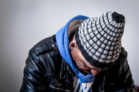 29 janvier 2016: Hosni Kaliya s'est immolé le 6 janvier 2011 après avroi été battu à deux reprises par des policiers de Kasserine. Cinq ans après, Hosni, brulé sur tout le corps doit vivre au quotidien avec des douleurs permanentes et le regard difficil de la société. Il vit actuellement dans un foyer social de l'Etat en attente d'être envoyé en Italie pour subir plusieurs interventions et poses de prothèses. Il y adeux mois son jeune frère s'est immolé à Kasserine et est décédé. l'immolation est devenu un phénoméne fréquent en Tunisie, en partie en mimétisme avec Mohamed Bouazizi, mais surtout comme un geste de desespoir d'une société et d'une jeunesse abandonnée (113 immolations en 2015).