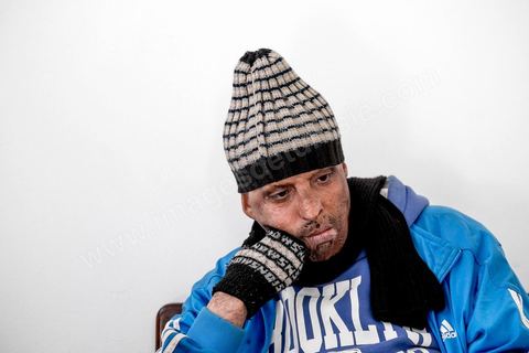 24 février 2016: Hosni Kaliya s'est immolé le 6 janvier 2011 après avroi été battu à deux reprises par des policiers de Kasserine. Cinq ans après, Hosni, brulé sur tout le corps doit vivre au quotidien avec des douleurs permanentes et le regard difficil de la société. Il vit actuellement dans un foyer social de l'Etat en attente d'être envoyé en Italie pour subir plusieurs interventions et poses de prothèses. Il y adeux mois son jeune frère s'est immolé à Kasserine et est décédé. l'immolation est devenu un phénoméne fréquent en Tunisie, en partie en mimétisme avec Mohamed Bouazizi, mais surtout comme un geste de desespoir d'une société et d'une jeunesse abandonnée (113 immolations en 2015).
