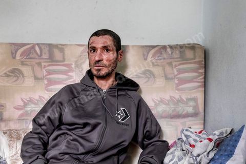 25 février 2016 : Baligh Aloui, 33 ans, s'est immolé le jeudi 21 janvier devant sa maison familiale où il vit avec ses parents, frères et soeur. C'est son frère, Abdelsattar, qui l'a sauvé en se jetant sur lui. Il est brulé au visage et mains au second degrès. Il s'est immolé ce jeudi 21 janvier, au lendemain de l'annonce de la création de 5000 emplois à Kasserine par le gouvernement. Ce jour là, les chômeurs se sont précipités au gouvernorat, aux délégations et aux municipalités pour s'inscrire dans un nouvel espoir d'avoir enfin un travail, une activité stable, un revenu digne, ... cet afflux a créé un désordre, un débordement, des tensions, ... ce jeune se voyant une nouvelle fois rejeté par l'administration, par l'état, est rentré chez lui avec une bouteille d'essence et s'est immolé dans la rue devant sa maison, devant sa mère, ses frères et soeurs. C'est à son frère qu'il doit sa survie, il a pu très vite l'éteindre, mais ce jeune est marqué à vie, brulé au second degrés sur l'ensemble du visage dans l'indifférence totale de la société et du gouvernement, en 2015 113 personnes se sont immolés en Tunisie.