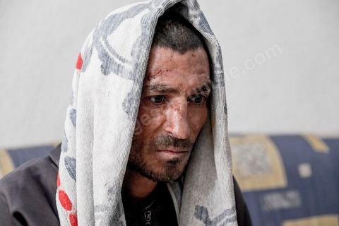 25 février 2016 : Baligh Aloui, 33 ans, s'est immolé le jeudi 21 janvier devant sa maison familiale où il vit avec ses parents, frères et soeur. C'est son frère, Abdelsattar, qui l'a sauvé en se jetant sur lui. Il est brulé au visage et mains au second degrès. Il s'est immolé ce jeudi 21 janvier, au lendemain de l'annonce de la création de 5000 emplois à Kasserine par le gouvernement. Ce jour là, les chômeurs se sont précipités au gouvernorat, aux délégations et aux municipalités pour s'inscrire dans un nouvel espoir d'avoir enfin un travail, une activité stable, un revenu digne, ... cet afflux a créé un désordre, un débordement, des tensions, ... ce jeune se voyant une nouvelle fois rejeté par l'administration, par l'état, est rentré chez lui avec une bouteille d'essence et s'est immolé dans la rue devant sa maison, devant sa mère, ses frères et soeurs. C'est à son frère qu'il doit sa survie, il a pu très vite l'éteindre, mais ce jeune est marqué à vie, brulé au second degrés sur l'ensemble du visage dans l'indifférence totale de la société et du gouvernement, en 2015 113 personnes se sont immolés en Tunisie.