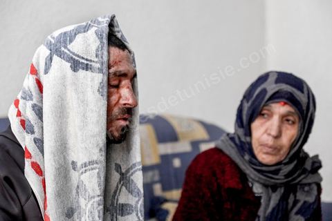 25 février 2016 : Baligh Aloui, 33 ans, s'est immolé le jeudi 21 janvier devant sa maison familiale où il vit avec ses parents, frères et soeur. C'est son frère, Abdelsattar, qui l'a sauvé en se jetant sur lui. Il est brulé au visage et mains au second degrès. Il s'est immolé ce jeudi 21 janvier, au lendemain de l'annonce de la création de 5000 emplois à Kasserine par le gouvernement. Ce jour là, les chômeurs se sont précipités au gouvernorat, aux délégations et aux municipalités pour s'inscrire dans un nouvel espoir d'avoir enfin un travail, une activité stable, un revenu digne, ... cet afflux a créé un désordre, un débordement, des tensions, ... ce jeune se voyant une nouvelle fois rejeté par l'administration, par l'état, est rentré chez lui avec une bouteille d'essence et s'est immolé dans la rue devant sa maison, devant sa mère, ses frères et soeurs. C'est à son frère qu'il doit sa survie, il a pu très vite l'éteindre, mais ce jeune est marqué à vie, brulé au second degrés sur l'ensemble du visage dans l'indifférence totale de la société et du gouvernement, en 2015 113 personnes se sont immolés en Tunisie.