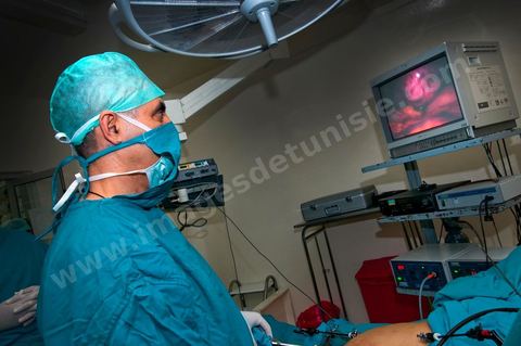 Le Dr Tahar Khalfallah, chirurgien, durant une opération chirurgicale au bloc opératoire à l'hopital Mongi Slim de la Marsa