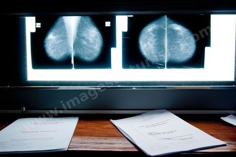 Service gratuit de mamographie au Centre de Recherche en Santé de la Repproduction de l'Ariana à Tunis - Office national de la Famille et de la Population - Ministère de la Santé Publique
