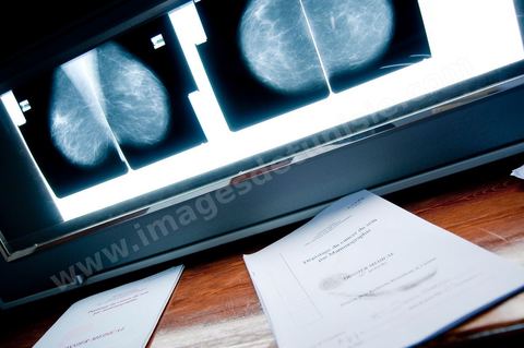 Service gratuit de mamographie au Centre de Recherche en Santé de la Repproduction de l'Ariana à Tunis - Office national de la Famille et de la Population - Ministère de la Santé Publique