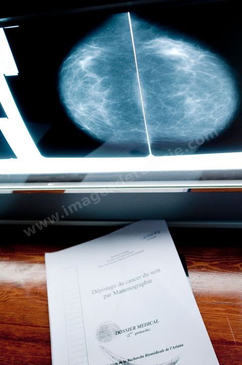 Service gratuit de mamographie au Centre de Recherche en Santé de la Repproduction de l'Ariana à Tunis - Office national de la Famille et de la Population - Ministère de la Santé Publique